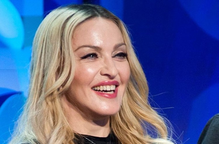 Madonna jokes about swelling after surgery in the new look - FactsWOW