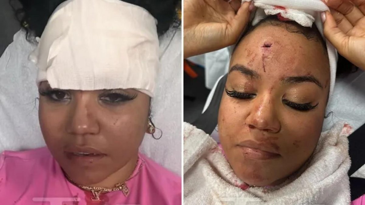 In La Concert Woman Smacked In The Head By 50 Cent’s Mic; Lawyer Denies It Was Intentional